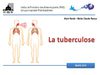 La tuberculose