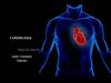 Trasplante cardiaco