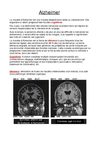 La maladie d'Alzheimer