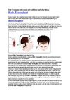 Hair Transplant self esteem and confidence and other things