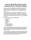 Learn About the Causes and Treatments for Clammy Hands
