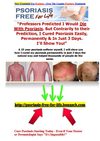 Natural Psoriasis Treatment - New Treatment For Psoriasis