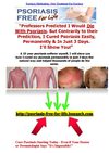 Psoriasis Medication - New Treatment For Psoriasis