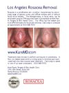 Rosacea Treatments in Los Angeles Premier Clinic - Kare Plastic Surgery 