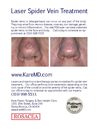 New FDA Laser for Spider Vein Treatments, Now Available at Kare Plastic Surgery - Los Angeles 
