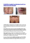 Yeast infection women - What is yeast infection - Yeast infection pregnancy
