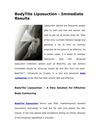 BodyTite Liposuction - Immediate Results