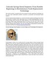 Colorado Springs Dental Implants: From Humble Beginnings to Revolutionary Tooth Replacement Technology
