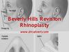 Beverly Hills rhinoplasty