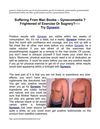 Gynexin Male Breast Reduction- Gynecomastia -Treatment