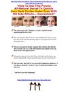  dark circles under eyes children - how to remove dark circles under eyes - how to reduce dark circles under eyes