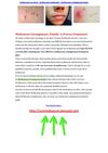  genital molluscum contagiosum - molluscum contagiosum treatment