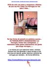  como curar verrugas - remedios para verrugas - tratamiento verrugas