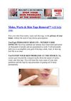 treatment for genital warts - genital warts cure - best wart remover 