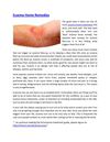 Eczema Home Remedies