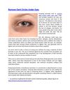 Remove Dark Circles Under Eyes