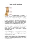 Causes Of Disc Herniation