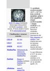 Tipos de ACV