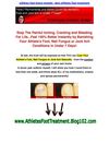 athletes foot home remedy - best athletes foot treatment