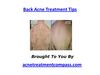 Back Acne Treatment Tips