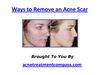 Ways to Remove an Acne Scar