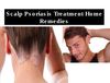 Scalp Psoriasis Treatment Home Remedies