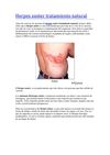 Herpes zoster tratamiento natural