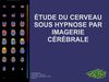 Étude du cerveau sous hypnose par imagerie cérébrale