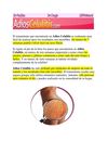como reducir las celulitis - como reducir celulitis en las piernas