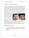 Facts about Cleft Lip and Cleft Palate