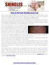 How To Remove Shingles Scars Fast-Pdf