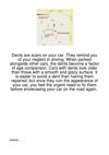 Dents-Are-Scars-On-Your-Car.-They-Remind-You-Of-Yo276