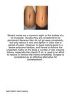 Stretch-Marks-Are-A-Common-Sight-On-The-Bodies-Of-21