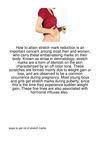 How-To-Attain-Stretch-Mark-Reduction-Is-An-Importa30