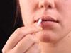 Herpes Simplex Virus Symptoms