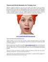 Natural And Herbal Remedies For Treating Acne