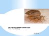 Bed Bugs - The Answers You Need to Protect Your Home from Bed Bugs