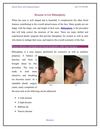 Reasons to Get Rhinoplasty