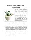 REMOVE YOUR ACNE SCARS NATURALLY