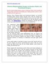 Effective Blepharoplasty Surgery at Houston Plastic and Craniofacial Surgery