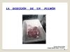 (Jacobo Gómez Portilla) Disección de pulmón de cordero