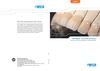 VIPI BLOCK - Cad/Cam Materials