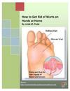 How to Get Rid of Warts on Hands at Home