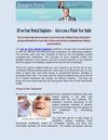 All on Four Dental Implants – Gives you a Whole New Smile