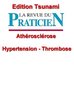 avc ischémique sylvien droit